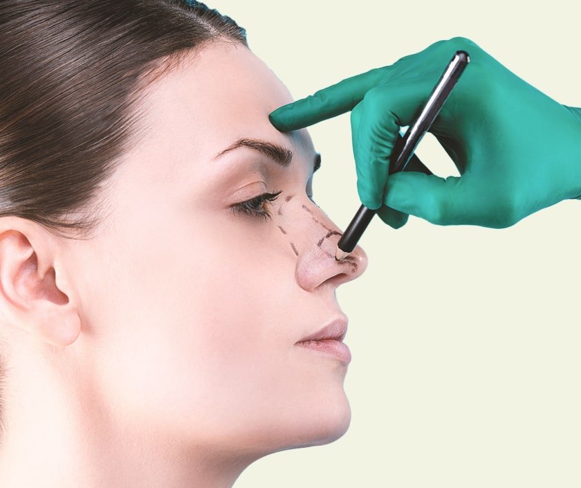 Rhinoplasty Service