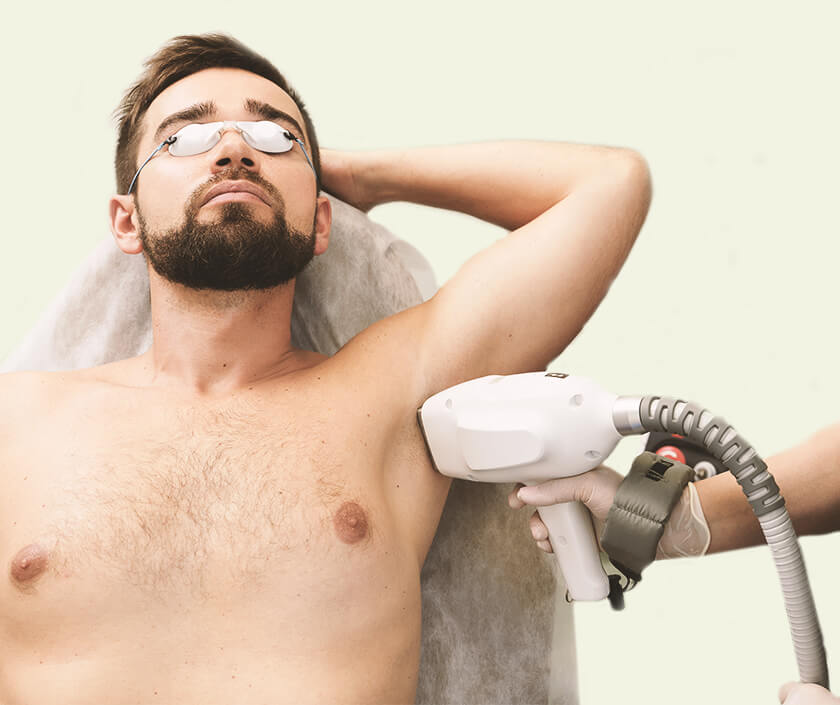 Laser Hair Removal For man