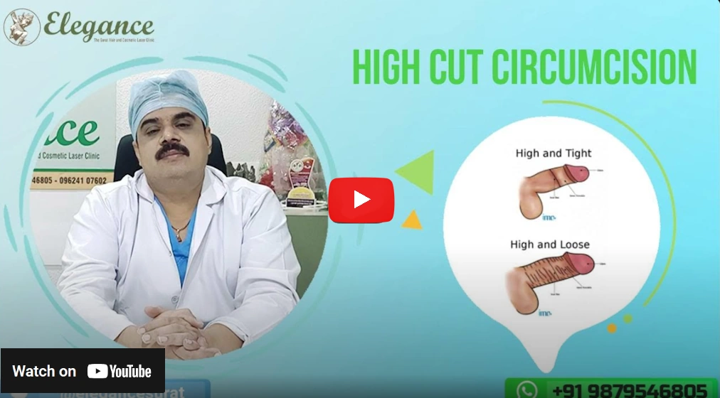 2001 Odyssey Plot Summary Types Of Circumcision Cuts StadionGucker de 2001 Odyssey Plot Summary Types Of Circumcision Cuts StadionGucker de