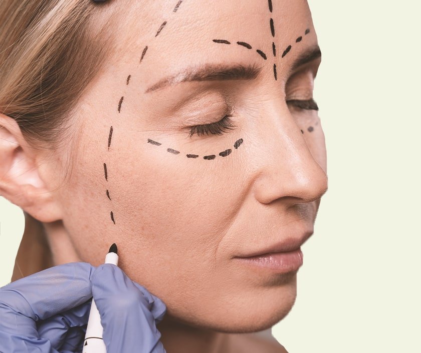 Fat Transfer For Contour Correction