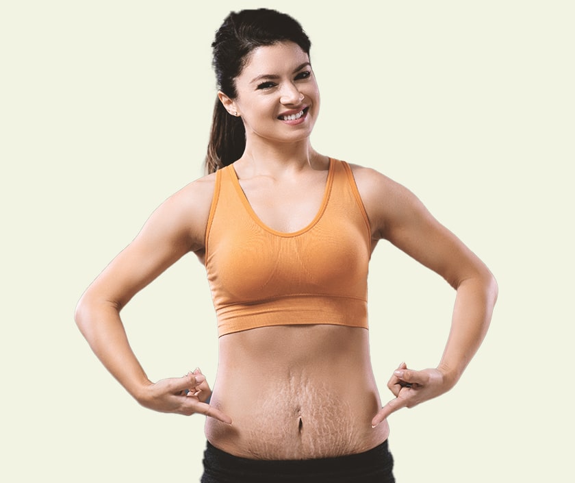 When Can You Do Post Bariatric Treatment in Body
