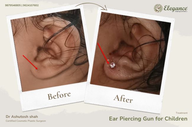 Ear Piercing Gun for Children_13