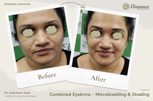 Combined Eyebrow - Microbladding & Shading