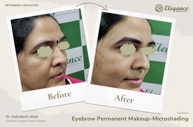 Eyebrow Permanent Makeup–Microshading