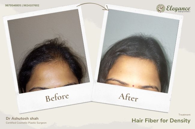 Hair Fiber for Density (2)