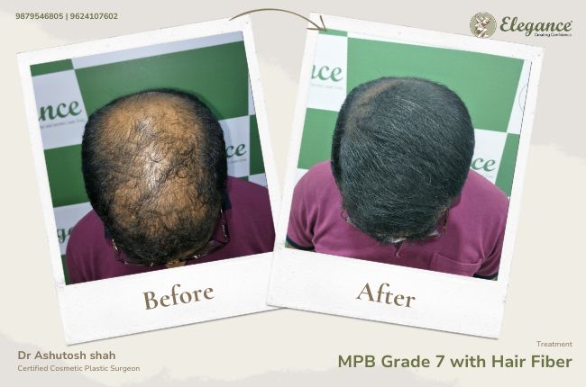 MPB Grade 7 with Hair Fiber