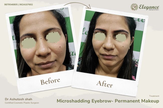 Microshadding Eyebrow- Permanent Makeup