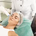 How MNRF Helps Reduce Acne and Scars Effectively