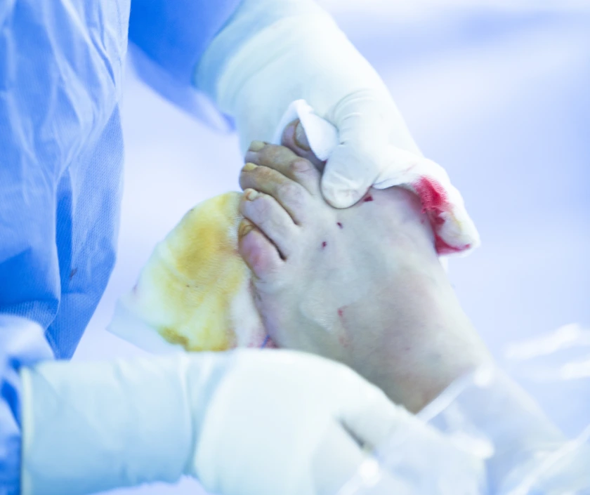 Hand and Foot Surgery