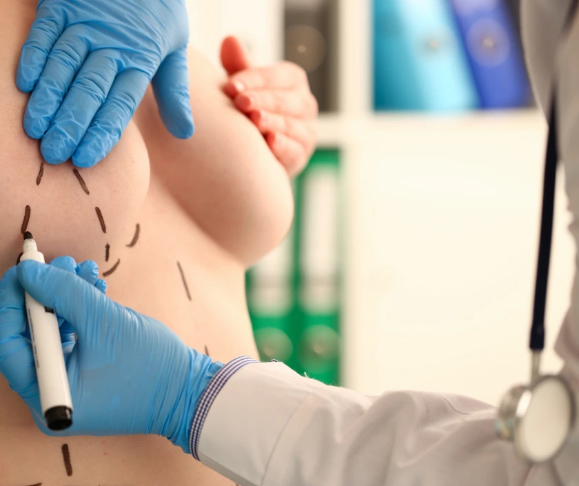 Post Cancer Reconstruction Surgery