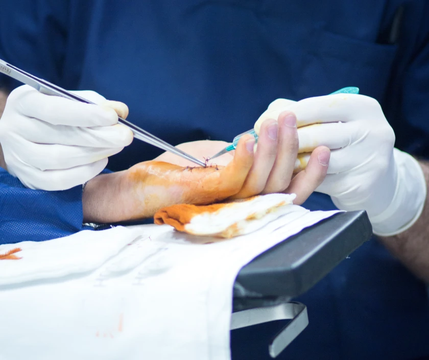Trauma Reconstruction
