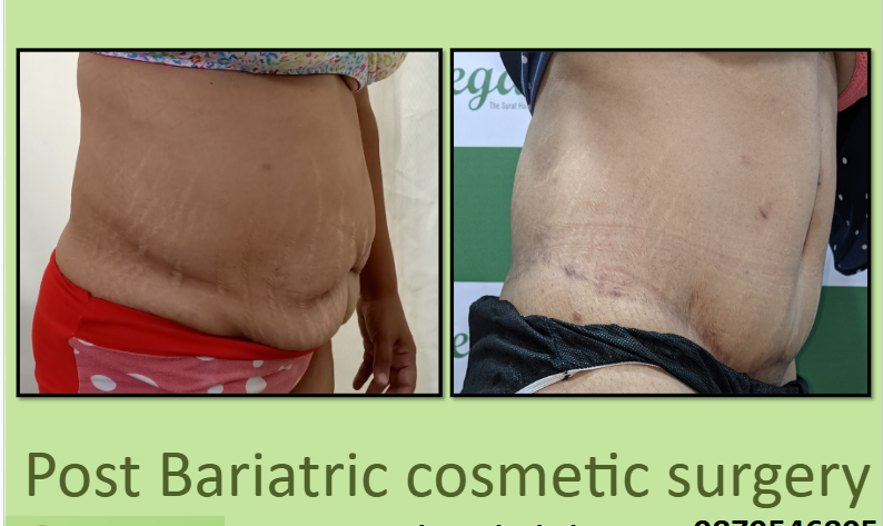 pet latak raha hai kya kare