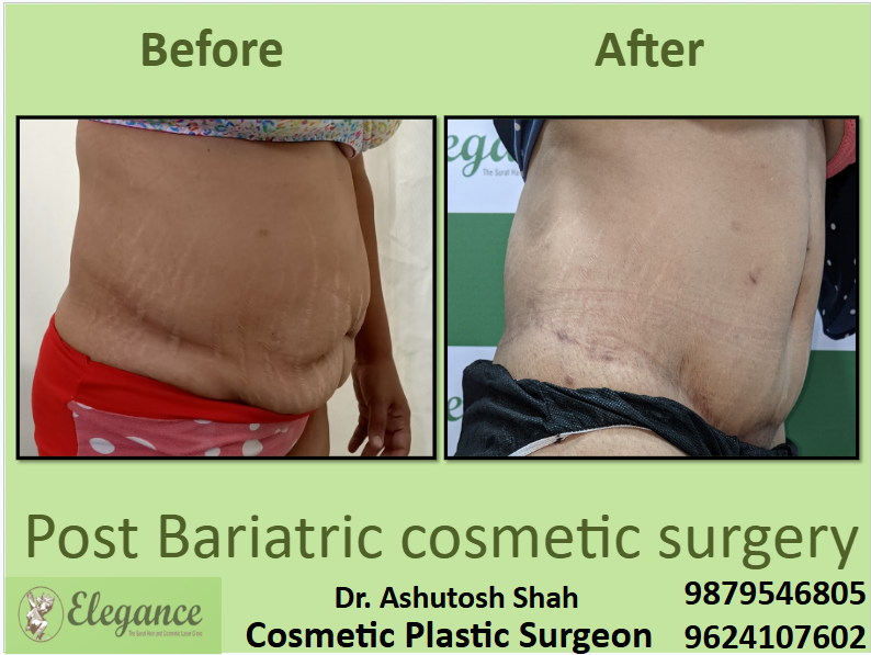 pet latak raha hai kya kare