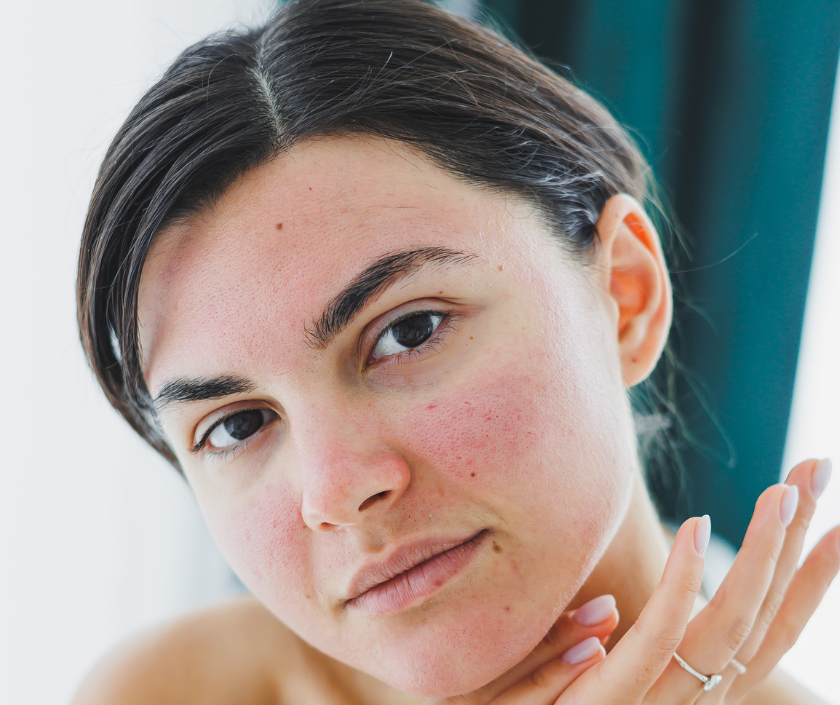 Sensitive skin - red reactive complexion that is easily irritated by products or environment