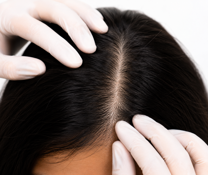 Hair & Scalp Analysis