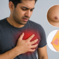 Why Do Men Experience a Chest Burning Feeling? Understanding Painful Gynecomastia