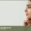 Double Chin Fat Removal: Options, Cost and Recovery