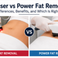 Laser vs Power Fat Removal: Key Differences, Benefits, and Which Is Right for You?