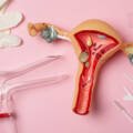 Hymen Repair Procedure: A Complete and Private Guide