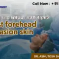 Scar Revision Surgery: Reduce Burn, Accident, Keloid and Acne Scars