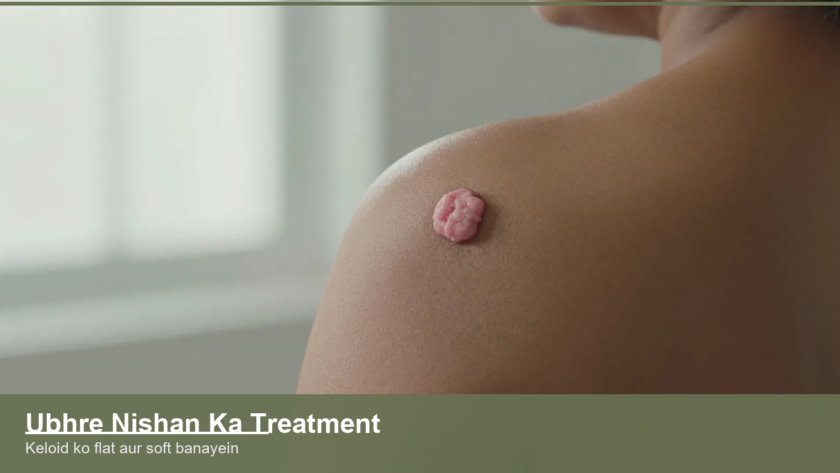 Close view of a raised keloid scar on the shoulder skin of an Indian person, showing thick scar tissue