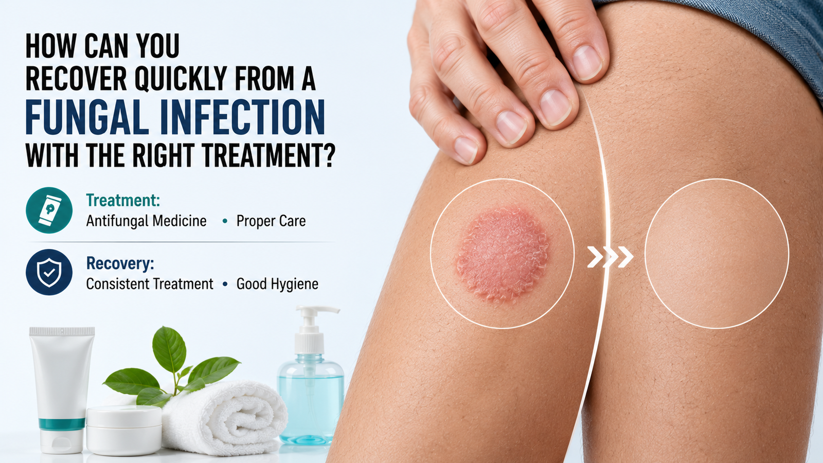 quick recovery fungal infection treatment