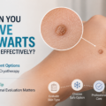 How Can You Remove Skin Warts Safely and Effectively?