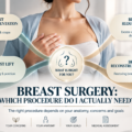 Breast Surgery: Which Procedure Do I Actually Need?