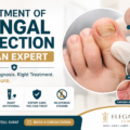 Treatment of Fungal Infection by an Expert: Why It Matters More Than You Think