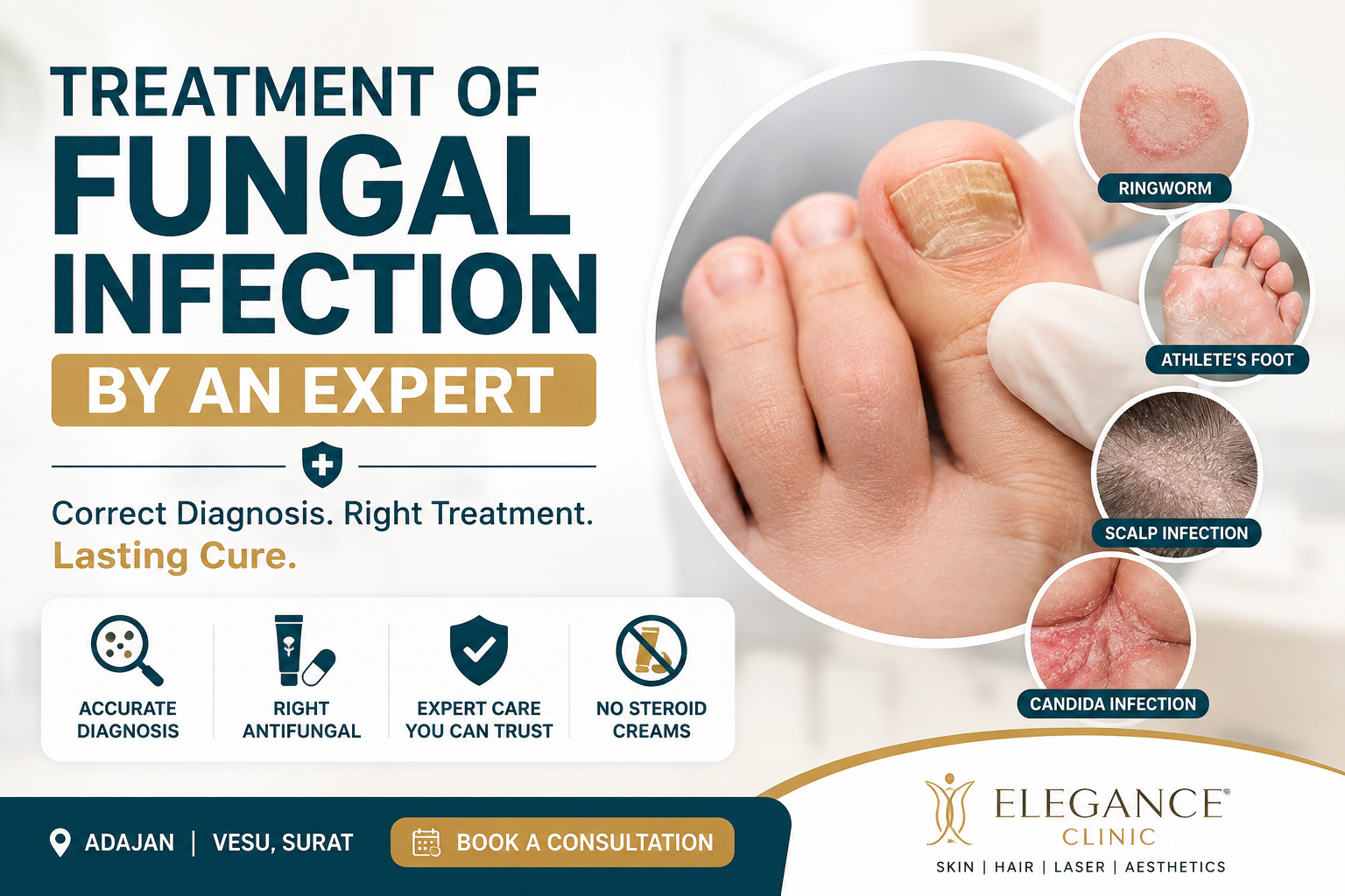 Fungal Infection