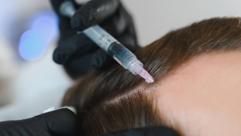 Hair Loss Treatment