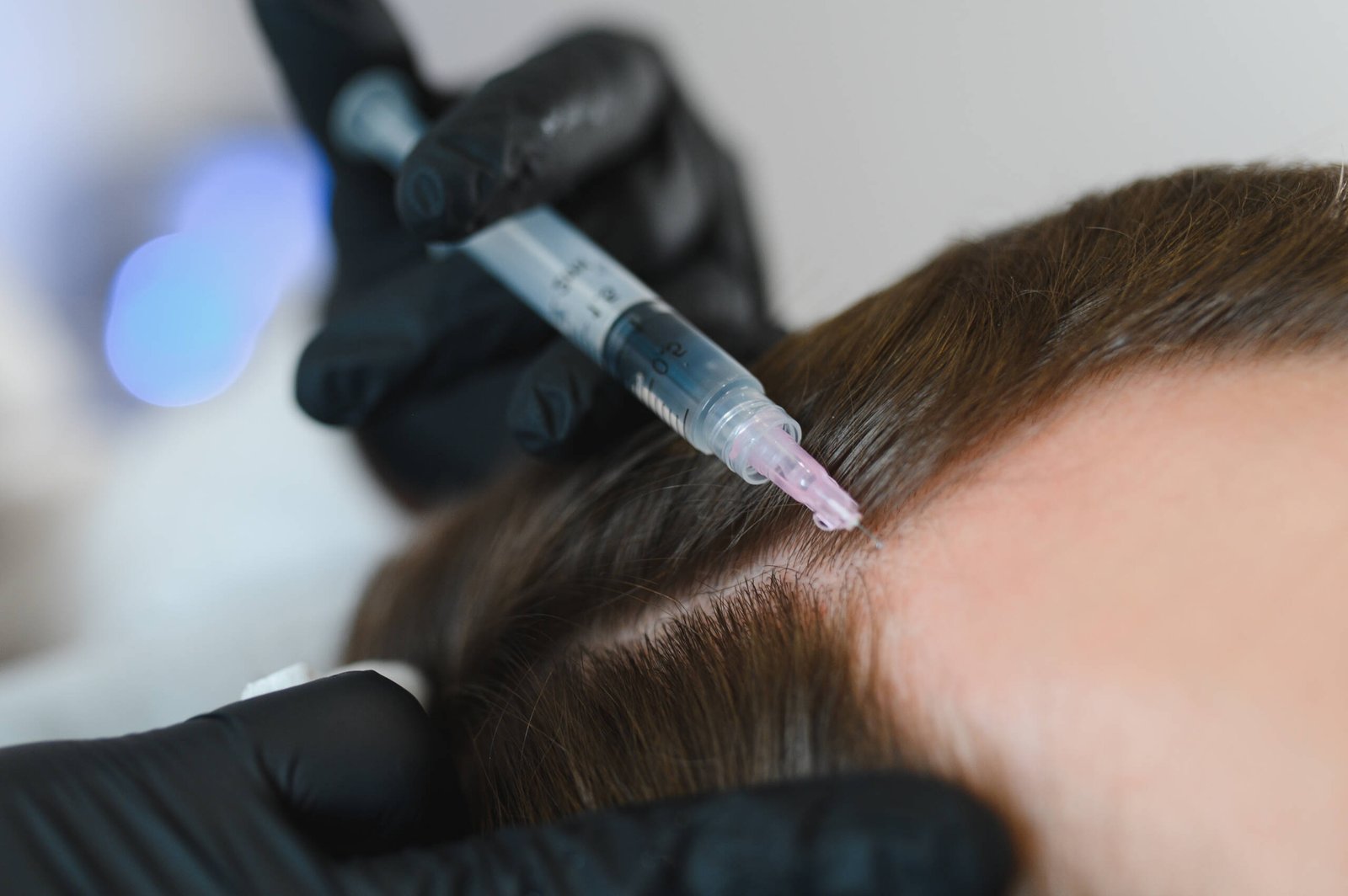 Hair Loss Treatment
