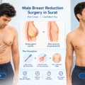 Male Breast Reduction Surgery in Surat: The Permanent Fix for a Puffy Chest