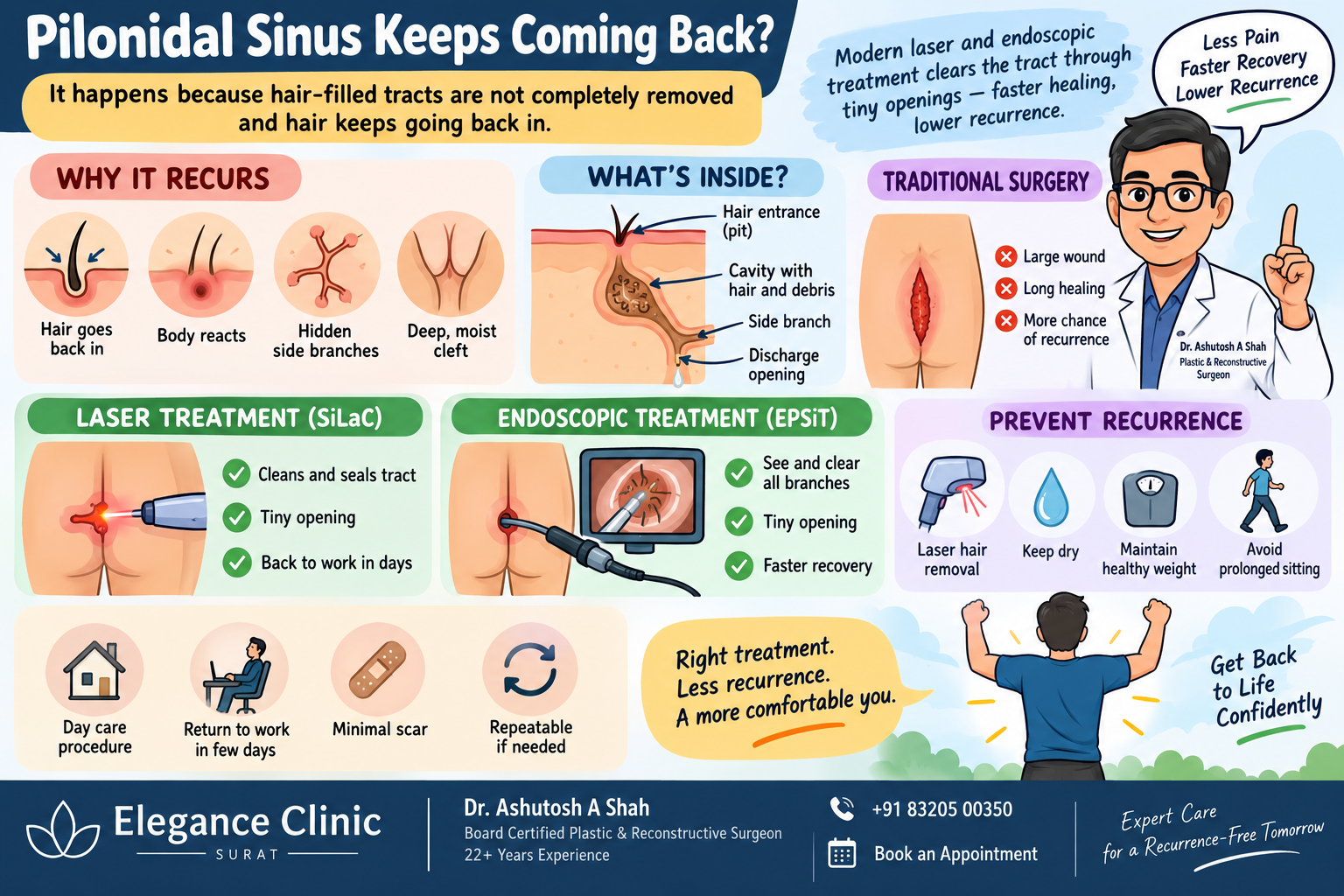 Pilodius sinus