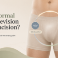 Is Pain Normal After Revision Circumcision?