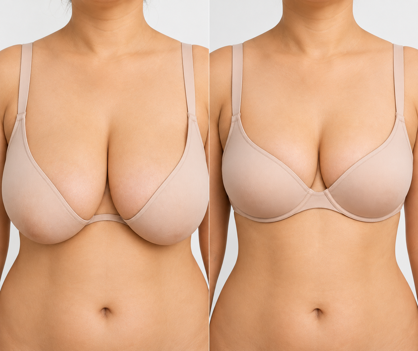 Breast Lift With Reduction