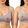 Areola Reduction with a Breast Lift: How It Works