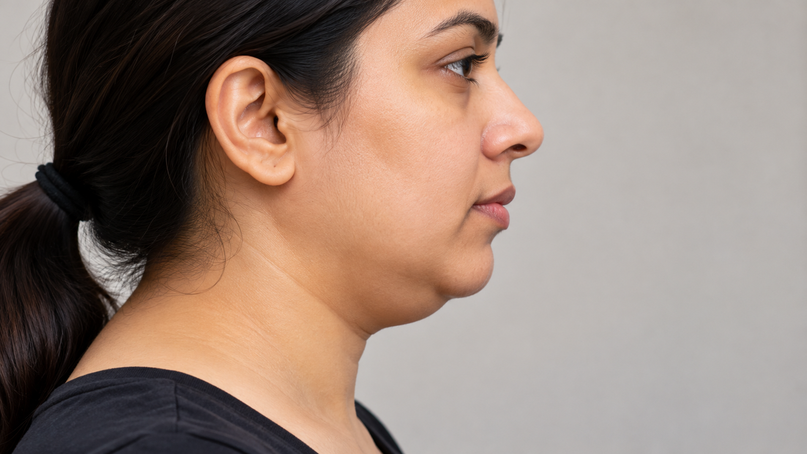 double chin liposuction vs injections
