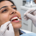 Gum Treatment Before Cosmetic Dentistry: Why It Matters